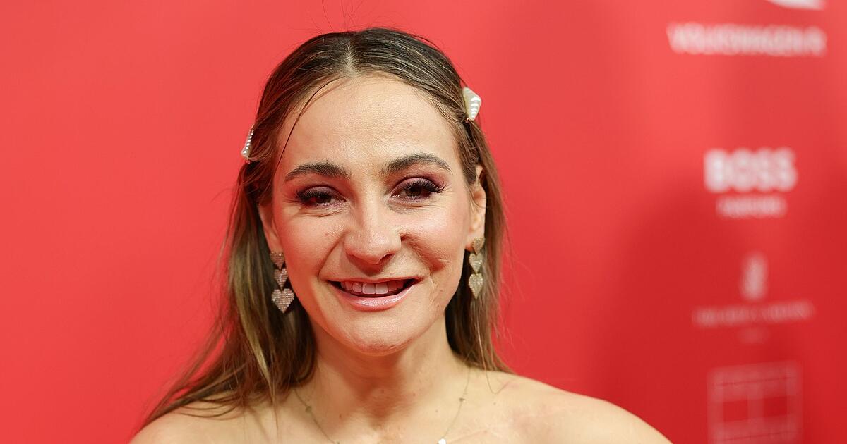 Kristina-Vogel-erkl-rt-warum-sie-acht-Jahre-nach-ihrem-Unfall-ein-erotisches-Shooting-wollte