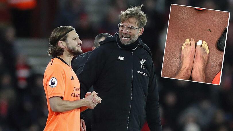 Adam Lallana und Jürgen Klopp. Im kleinen Bild die Zehen des Fußballers nach dem Spiel.