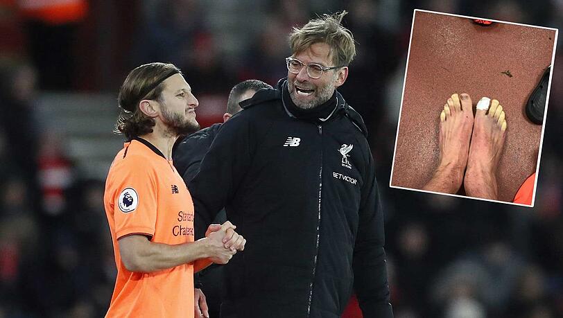 Adam Lallana und Jürgen Klopp. Im kleinen Bild die Zehen des Fußballers nach dem Spiel. Adam Lallana und Jürgen Klopp. Im kleinen Bild die Zehen des Fußballers nach dem Spiel.
