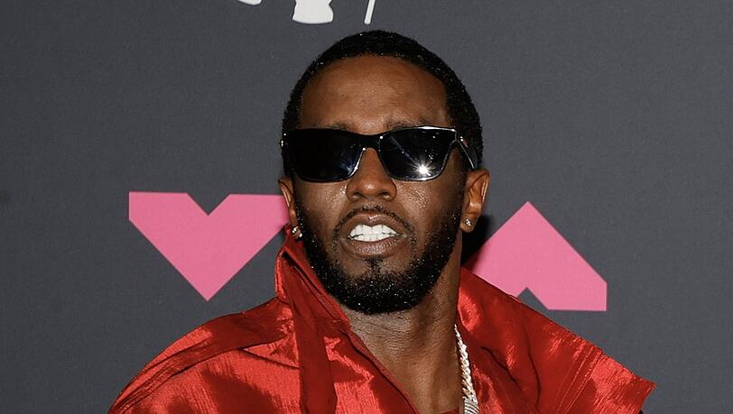 Diddy soll sich am Kopf verletzt haben. Diddy soll sich am Kopf verletzt haben.