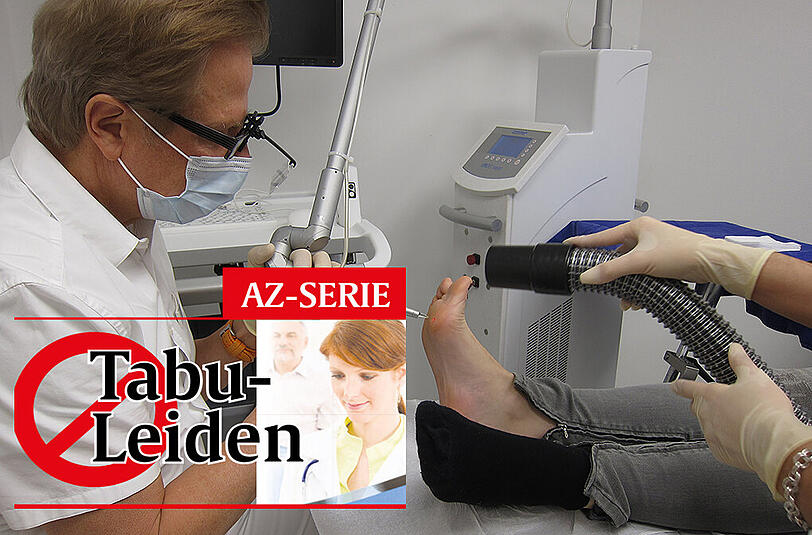Dr. Hans-Ulrich Voigt behandelt eine Warzen-Patientin mit einem Laser.