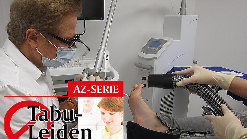 Dr. Hans-Ulrich Voigt behandelt eine Warzen-Patientin mit einem Laser. Dr. Hans-Ulrich Voigt behandelt eine Warzen-Patientin mit einem Laser.