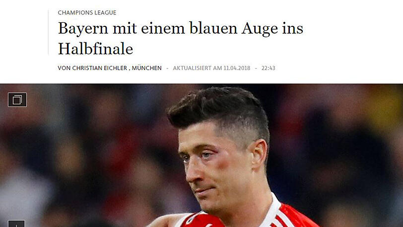 Die FAZ titelt: "Bayern mit einem blauen Auge ins Halbfinale"