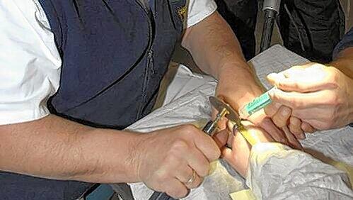 Operation geglückt: Mit Spezialwerkzeug trennt die Feuerwehr den zu engen Ring vom Finger einer 21-Jährigen Münchnerin Operation geglückt: Mit Spezialwerkzeug trennt die Feuerwehr den zu engen Ring vom Finger einer 21-Jährigen Münchnerin