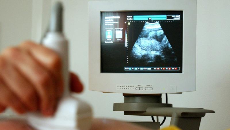 Eine Hebamme untersucht mit Ultraschall den Bauch einer Schwangeren Eine Hebamme untersucht mit Ultraschall den Bauch einer Schwangeren