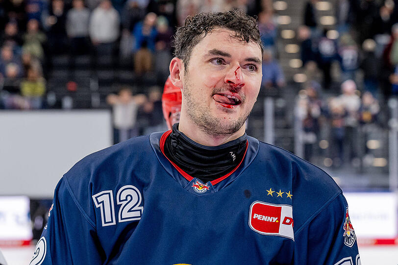 Gezeichnet von der Prügelei mit den Schwenningern: Brady Ferguson. Gezeichnet von der Prügelei mit den Schwenningern: Brady Ferguson.