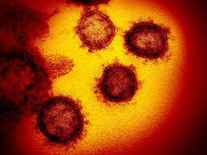 Eine undatierte elektronenmikroskopische Aufnahme des Coronavirus (SARS-CoV-2). Foto: NIAID-RML/AP/dpa/Symbolbild