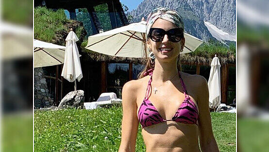 Eine Narbe unter der Brust erinnert Cathy Hummels stets an ihre Gürtelrose.