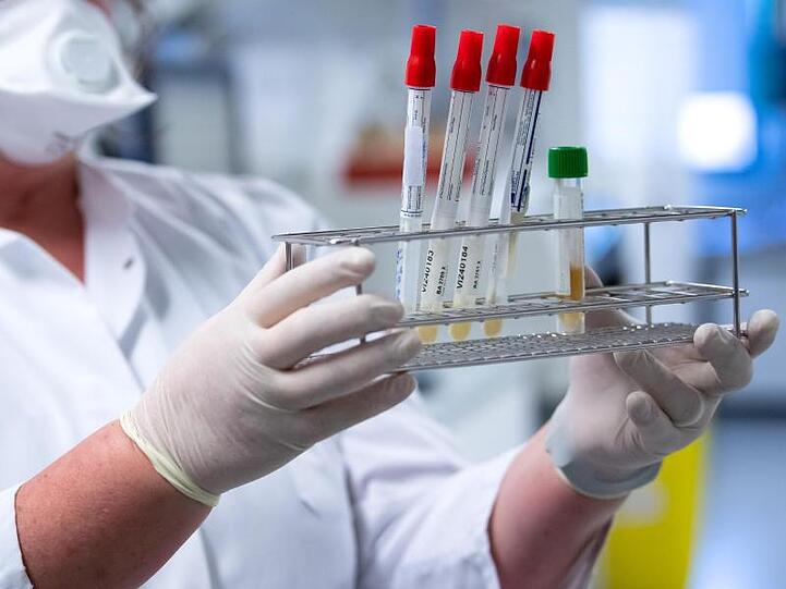 Eine Mitarbeiterin bereitet Proben von Menschen mit Covid-19 Verdacht für die weitere Analyse vor. Foto: Sven Hoppe/dpa/Symbolbild