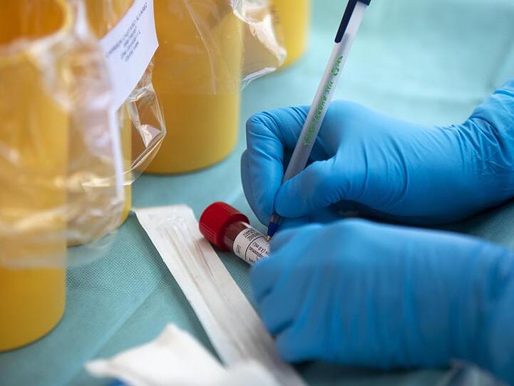 Besonders hohe Zahlen registrierter Infektionen haben Bayern, Nordrhein-Westfalen sowie Baden-Württemberg.