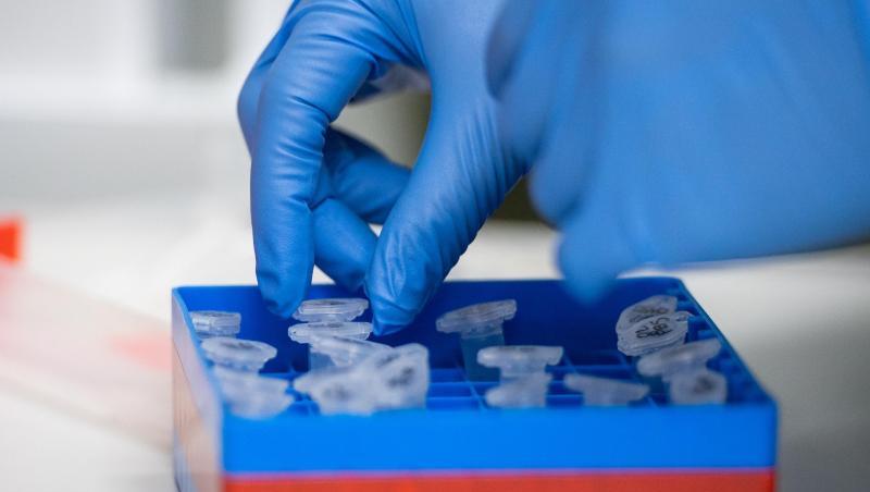 Eine Laborantin führt Untersuchungen zum Coronavirus durch.