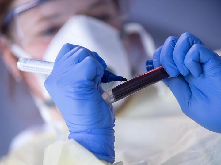 Ein Mitarbeiterin des Robert Koch-Instituts (RKI) beschriftet eine Blutprobe.