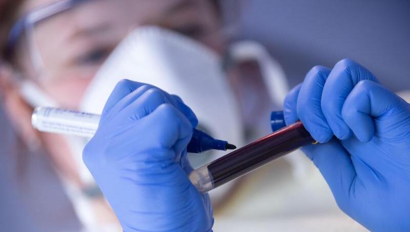 Ein Mitarbeiterin des Robert Koch-Instituts (RKI) beschriftet eine Blutprobe. Ein Mitarbeiterin des Robert Koch-Instituts (RKI) beschriftet eine Blutprobe.