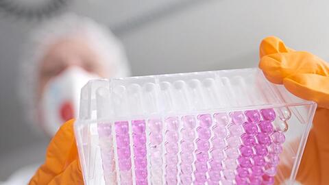 Eine Virologin untersucht Proben auf das Coronavirus. Foto: Peter Steffen/dpa/Symbolbild