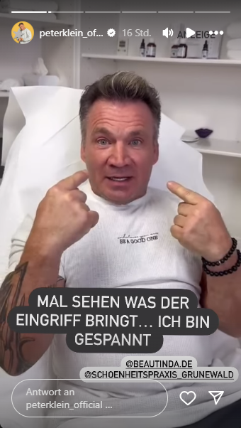 Peter Klein ließ sich sein Gesicht straffen. Peter Klein ließ sich sein Gesicht straffen.