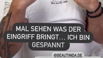 Peter Klein ließ sich sein Gesicht straffen. Peter Klein ließ sich sein Gesicht straffen.