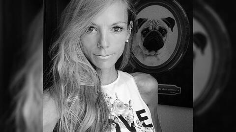 Die frühere "Miss Sachsen" Henriette Hömke ist in Ägypten an Magersucht gestorben