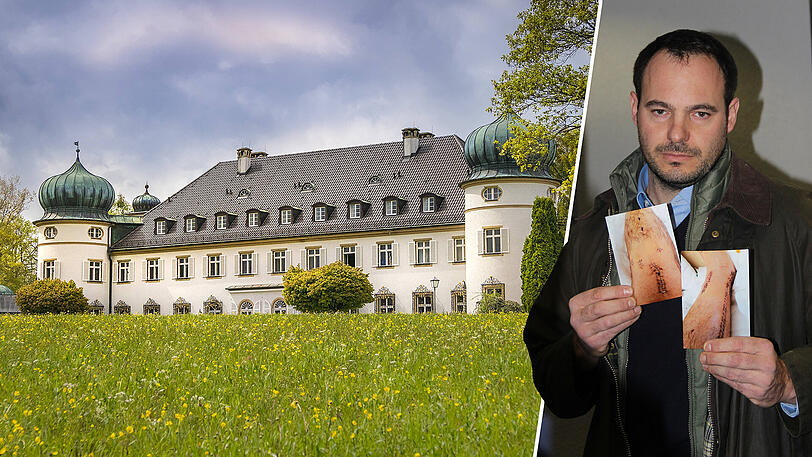 Blutige Folgen der Feier auf dem idyllischen Schloss Höhenried: Sönke L. mit Bildern seiner Verletzung am rechten Unterschenkel.