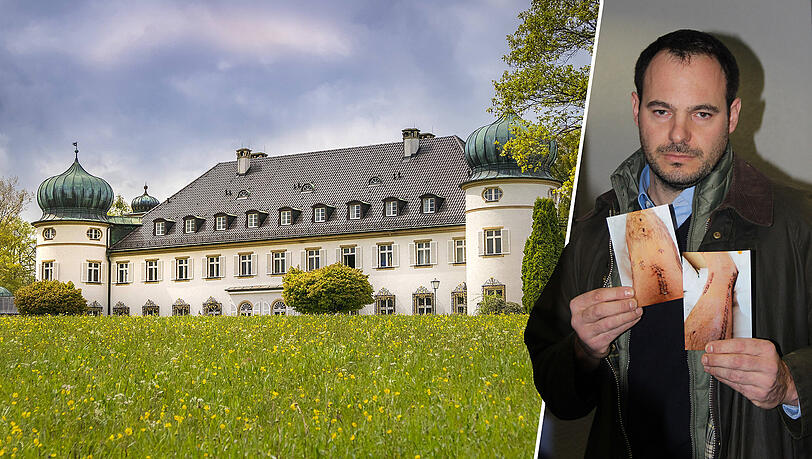 Blutige Folgen der Feier auf dem idyllischen Schloss Höhenried: Sönke L. mit Bildern seiner Verletzung am rechten Unterschenkel. Blutige Folgen der Feier auf dem idyllischen Schloss Höhenried: Sönke L. mit Bildern seiner Verletzung am rechten Unterschenkel.