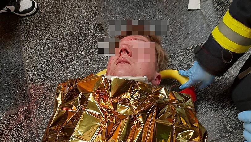 Der 17-Jährige liegt nach der Prügelattacke schwer verletzt am Boden und wird von Rettungskräften versorgt. Der 17-Jährige liegt nach der Prügelattacke schwer verletzt am Boden und wird von Rettungskräften versorgt.