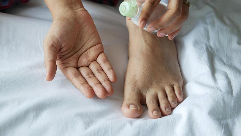 Laut Schätzungen leiden rund 15 Prozent der Bevölkerung an Nagelpilz.