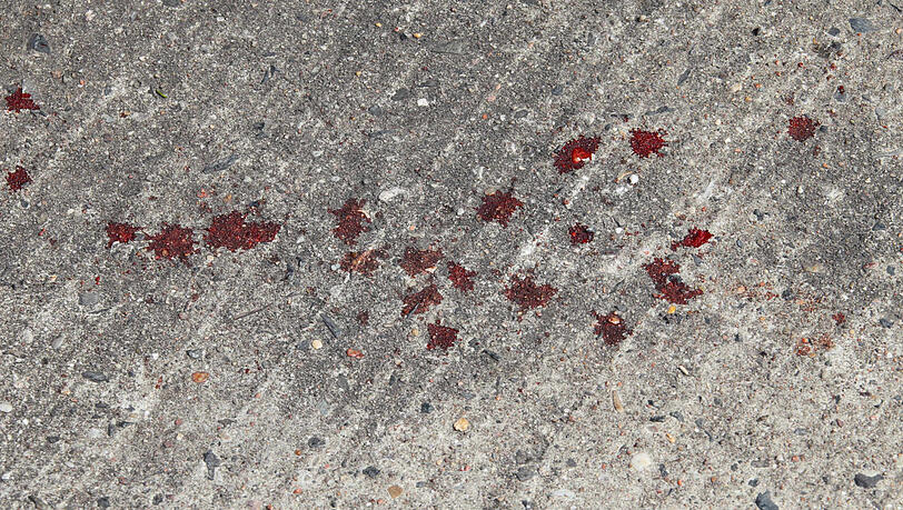 Die Jugendlichen folgten der Blutspur bis in den Wald. (Archivbild) Die Jugendlichen folgten der Blutspur bis in den Wald. (Archivbild)