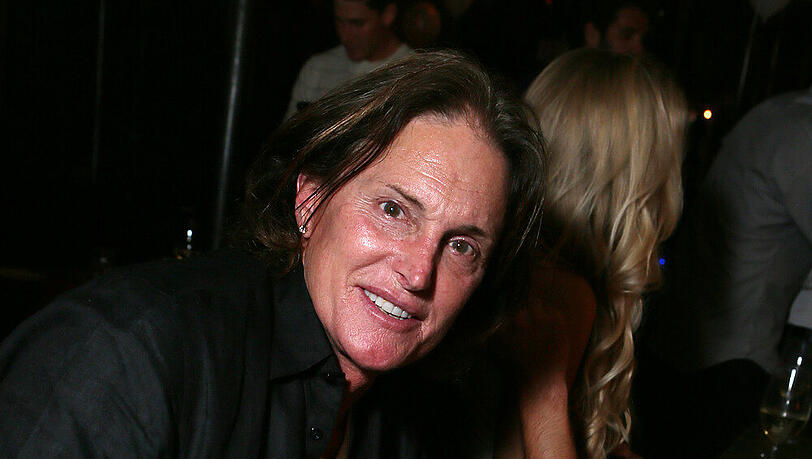 Bruce Jenner hat mit den Folgen eines Autounfalls zu kämpfen Bruce Jenner hat mit den Folgen eines Autounfalls zu kämpfen
