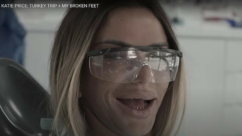 Bitte lächeln: So sieht Katie Price ohne ihre künstlichen Zähne aus.