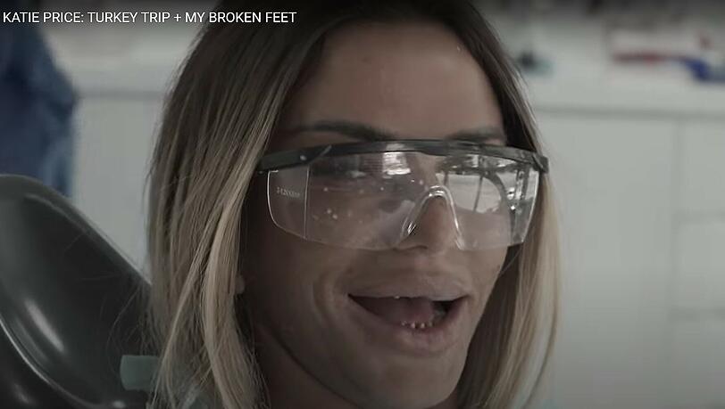 Bitte lächeln: So sieht Katie Price ohne ihre künstlichen Zähne aus. Bitte lächeln: So sieht Katie Price ohne ihre künstlichen Zähne aus.