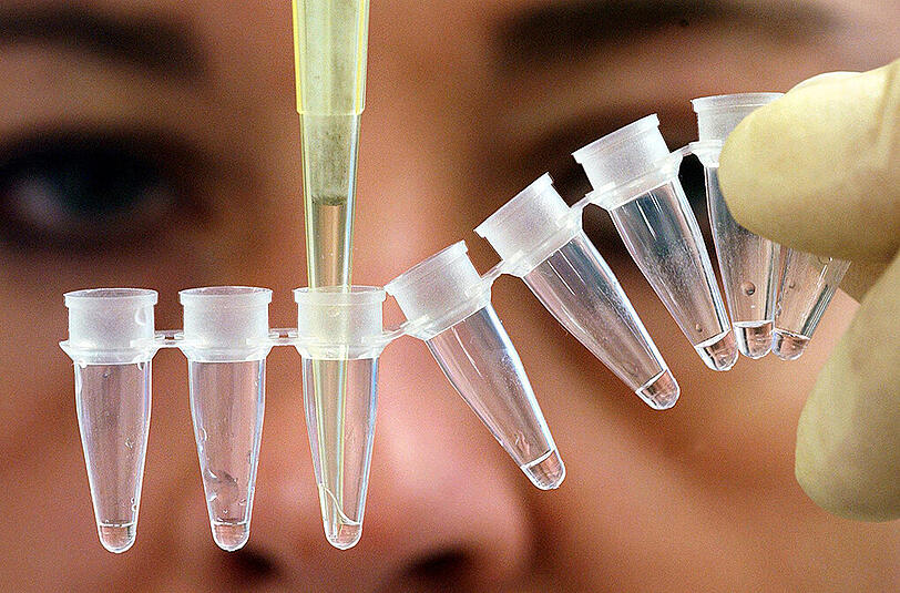 Vaterschaftstest im Genlabor: Das Bundesverfassungsgericht hat entschieden, dass eine Frau einen Mann, den sie für ihren Vater hält, nicht zum DNA-Test zwingen kann. Foto: Boris Roessler/Illustration