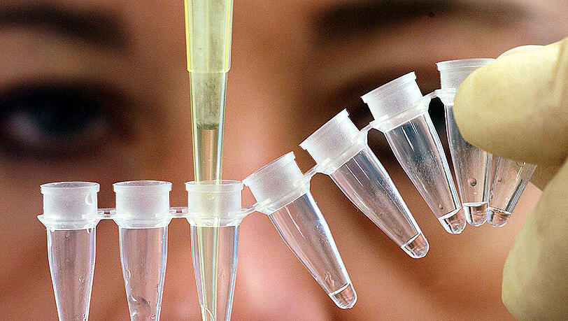 Vaterschaftstest im Genlabor: Das Bundesverfassungsgericht hat entschieden, dass eine Frau einen Mann, den sie für ihren Vater hält, nicht zum DNA-Test zwingen kann. Foto: Boris Roessler/Illustration Vaterschaftstest im Genlabor: Das Bundesverfassungsgericht hat entschieden, dass eine Frau einen Mann, den sie für ihren Vater hält, nicht zum DNA-Test zwingen kann. Foto: Boris Roessler/Illustration