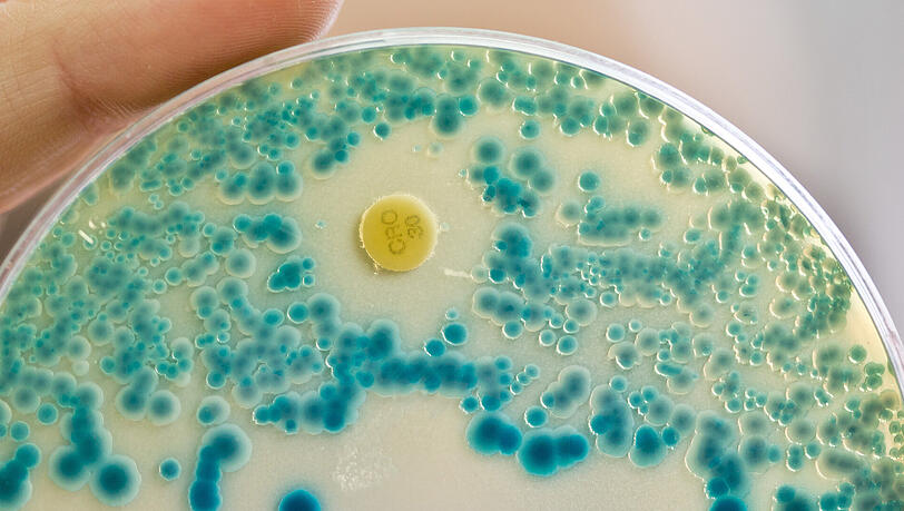 Wenn Antibiotika über Tiere in den menschlichen Körper gelangen, kann dieser resistente Keime dagegen bilden. Wenn Antibiotika über Tiere in den menschlichen Körper gelangen, kann dieser resistente Keime dagegen bilden.