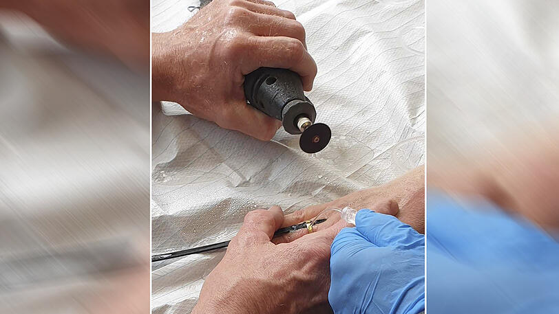 Mit einem Spezialwerkzeug rückte die Feuerwehr dem Ring zu Leibe.