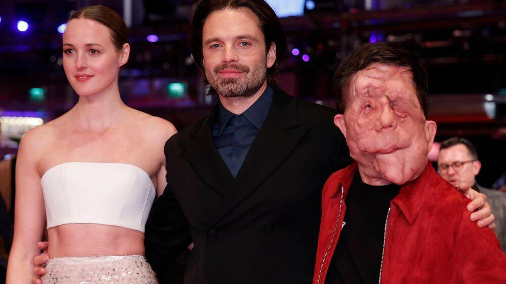 Entstellter BerlinaleStar Adam Pearson begeistert bei Premiere