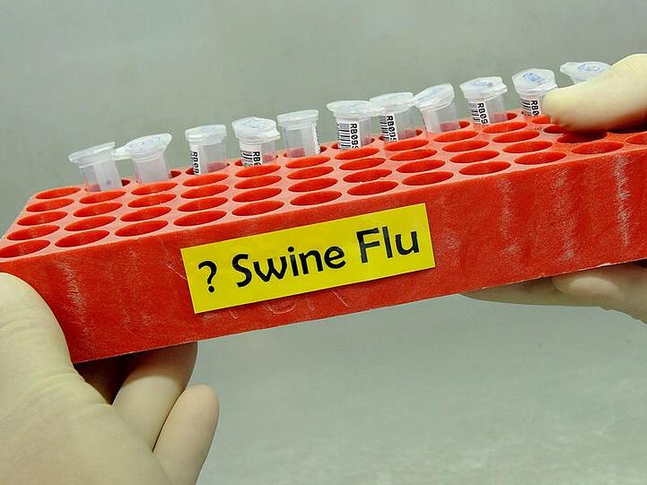 Das Landesamt für Gesundheit und Lebensmittelsicherheit bestätigte die vier neuen Erkrankungen.