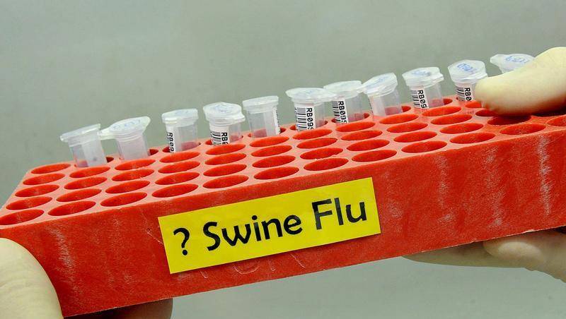 Das Landesamt für Gesundheit und Lebensmittelsicherheit bestätigte die vier neuen Erkrankungen.
