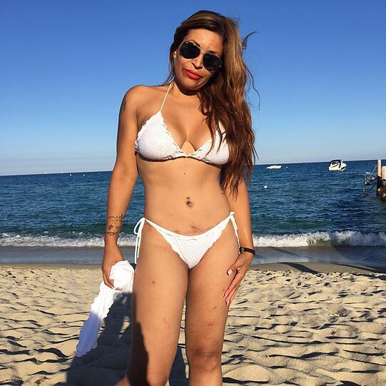 Patricia Blanco hat 55 Kilo abgenommen