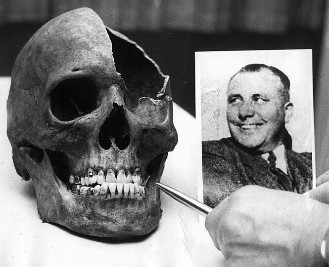 Für die zweifelnden Angehörigen von Rudolf Heß kontrollierte Eisenmenger, ob Hitlers Stellvertreter Suizid begangen hatte.