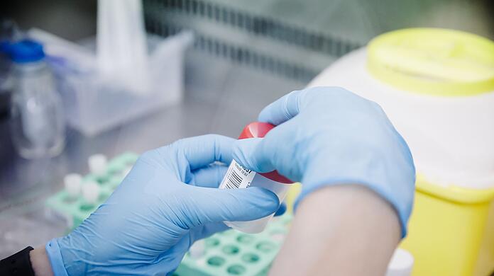 Eine Krankenschwester führt im Krankenhaus Ramon y Cajal in Madrid einen PCR-Test zur Erkennung des Affenpockenvirus durch.