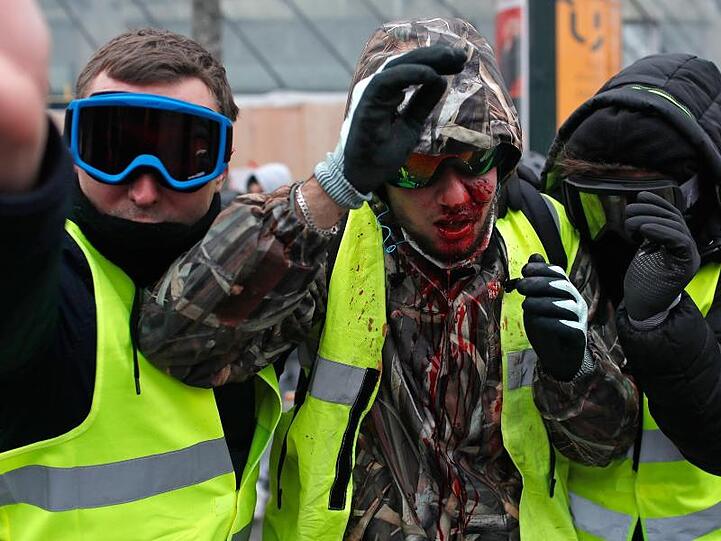 Ein Demonstrant der "Gilets Jaunes" (Gelbwesten) ist mit Blut bedeckt, nachdem er bei den Auseinandersetzungen verletzt wurde.