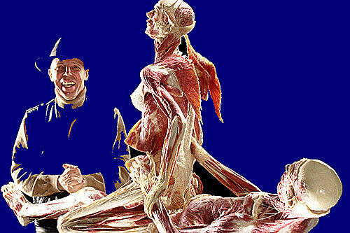 Sorgte für Aufruhr: Das bereits gezeigte Plastinat