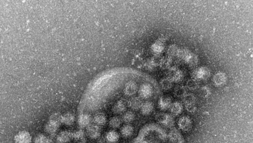 Das Norovirus ist sehr leicht übertragbar und gehört zu den weltweit häufigsten Erregern für plötzlich auftretenden Brechdurchfall.