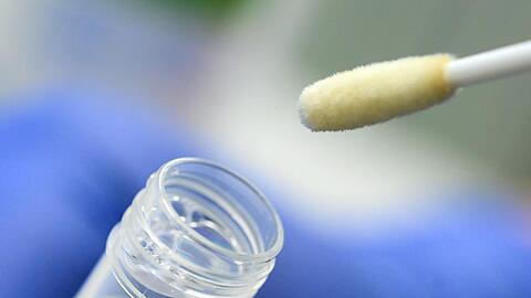 Ein Abstrich für das Testverfahren auf das Coronavirus.