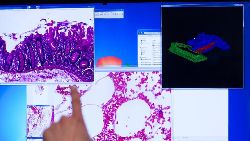 Die Krebs-Diagnostik rückt in Zeiten der Corona-Pandemie möglicherweise gefährlich in den Hintergrund. Die Krebs-Diagnostik rückt in Zeiten der Corona-Pandemie möglicherweise gefährlich in den Hintergrund.