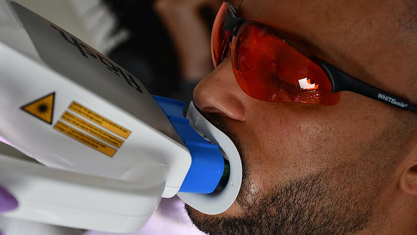 Bleaching und Veneers: Domenico De Cicco lässt seine Zähne optisch verschönern. Bleaching und Veneers: Domenico De Cicco lässt seine Zähne optisch verschönern.