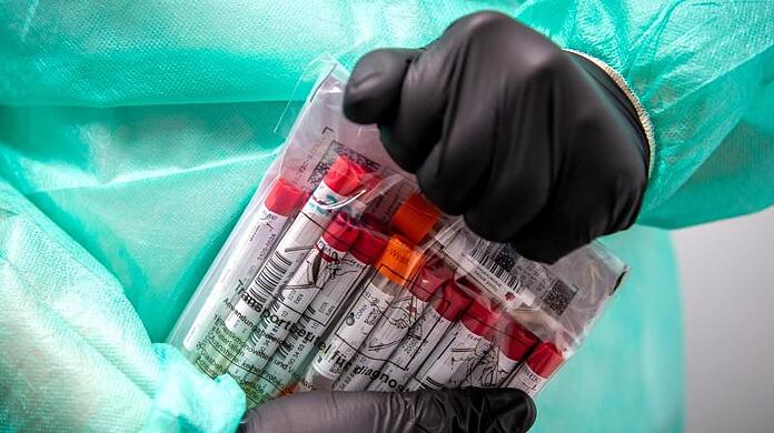 Proben für einen PCR-Test werden von einem Laboranten verpackt.