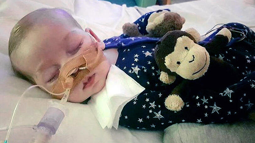 Das undatierte Foto zeigt das todkranke britische Baby Charlie Gard.