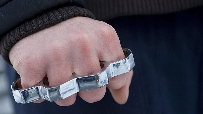 Dem 17-Jährigen wurde wohl mit einem Schlagring ins Gesicht geschlagen. (Symbolbild)
