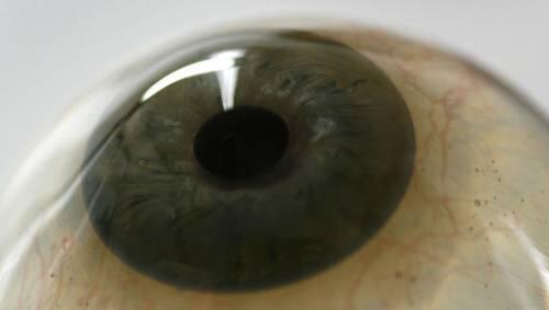 Hoch komplex und sehr verwundbar: das menschliche Auge. Hoch komplex und sehr verwundbar: das menschliche Auge.