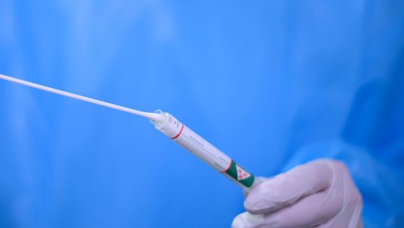 Ein Arzt hält einen Coronavirus-Test in den Händen. (Symbolbild)
